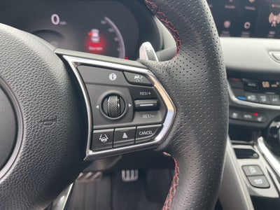 2025 Acura TLX A-Spec Package SH-AWD